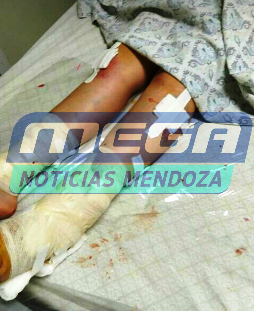 heridas