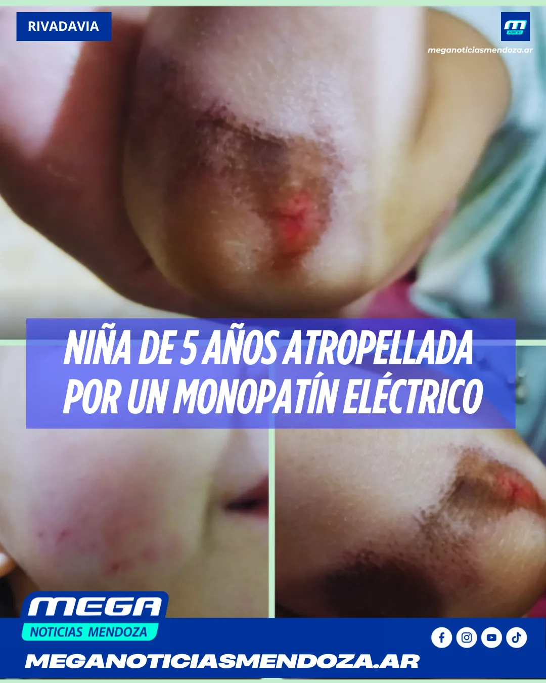 MONOPATIN ok
