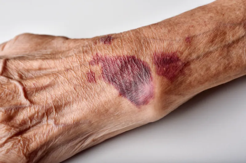 What-are-the-Different-Types-of-Elder-Abuse-and-How-to-Spot-Them